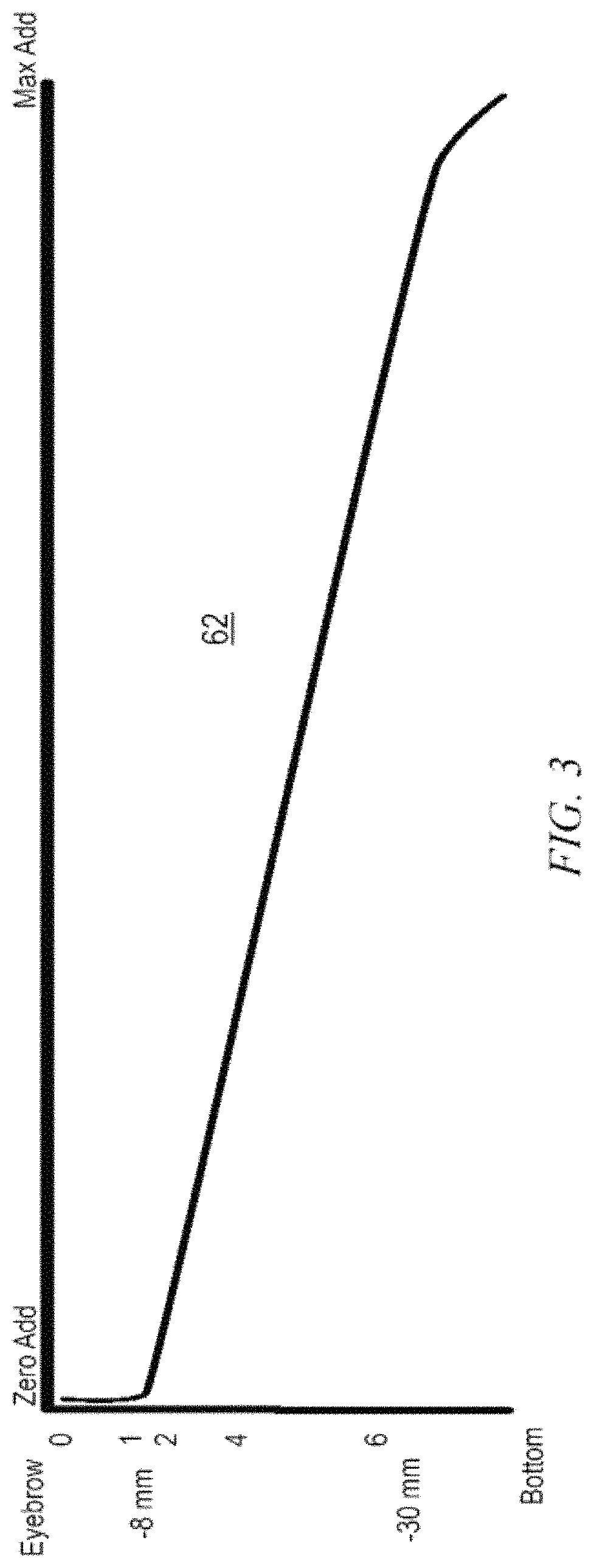 Broadview natural addition lens