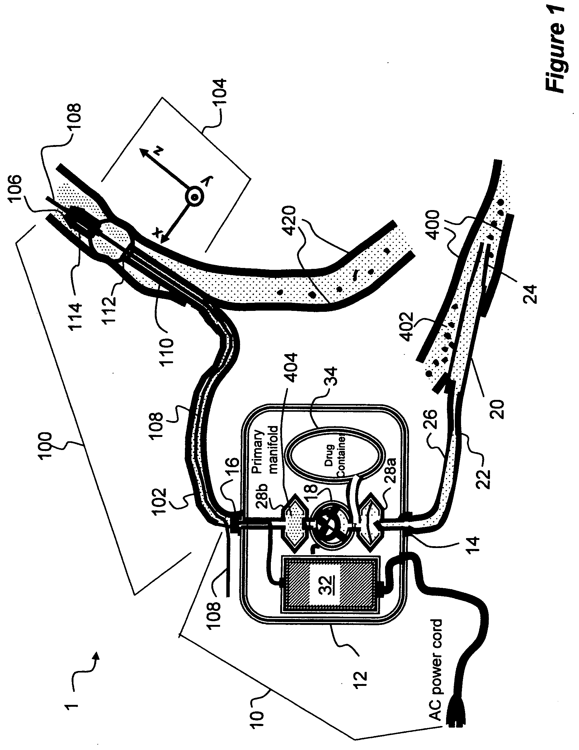 Apparatus and method for ablating deposits from blood vessel