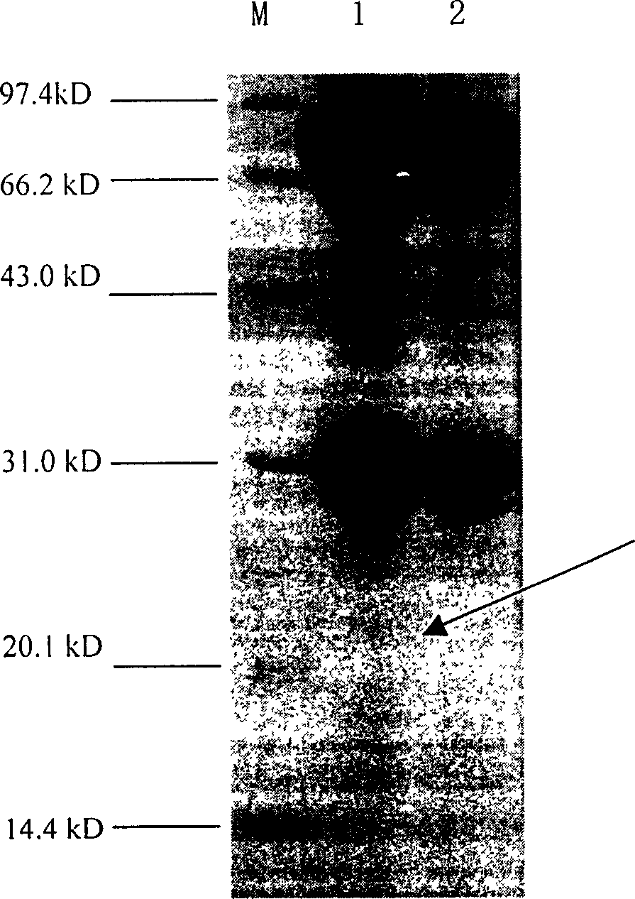 Recombinant Baculovirus for expressing CTB and human insulin fusion protein and use thereof