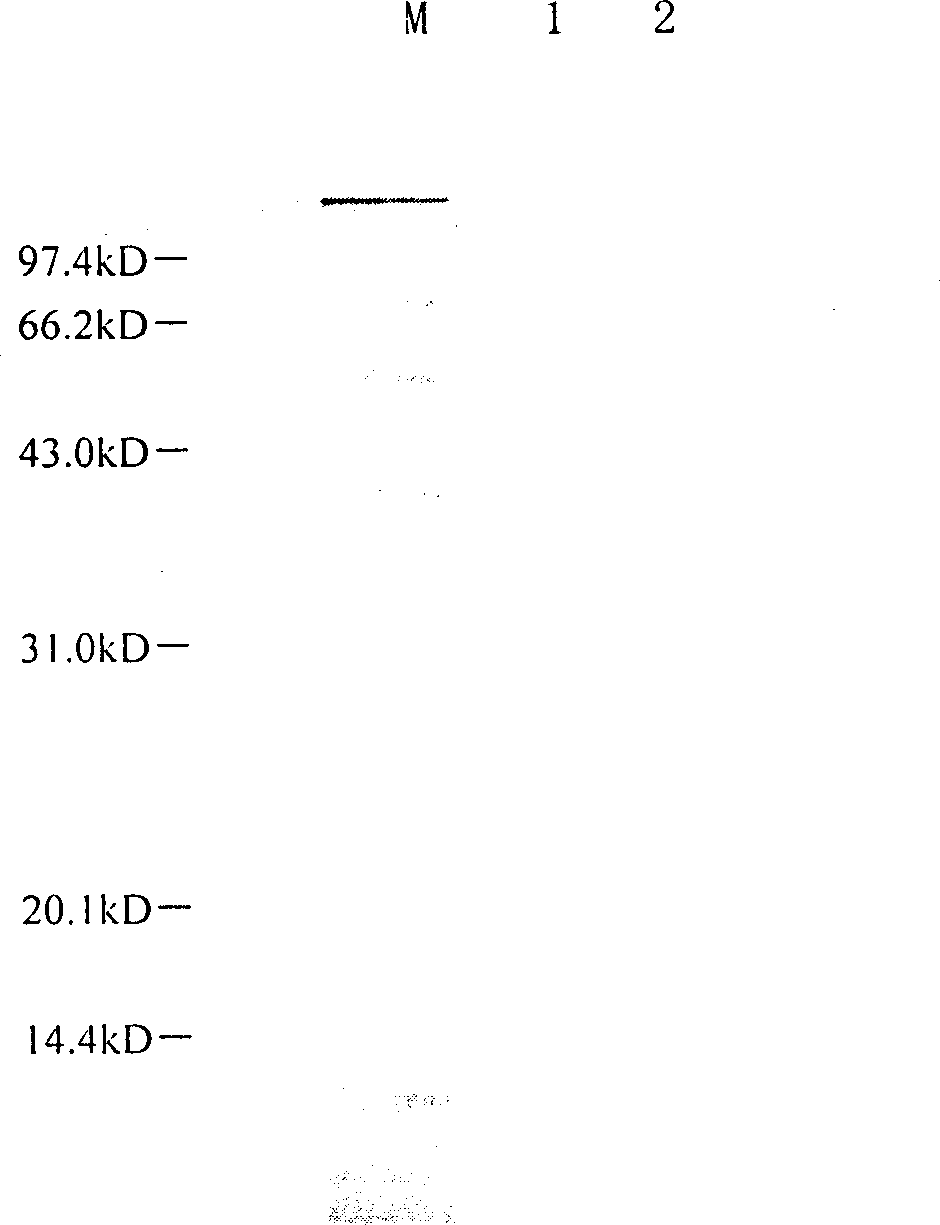 Recombinant Baculovirus for expressing CTB and human insulin fusion protein and use thereof