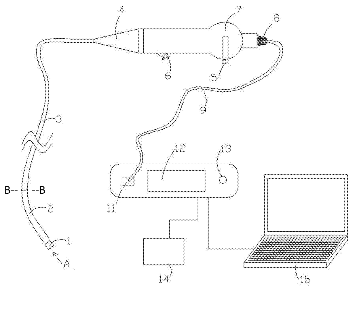 Flexible Digital Ureteroscope