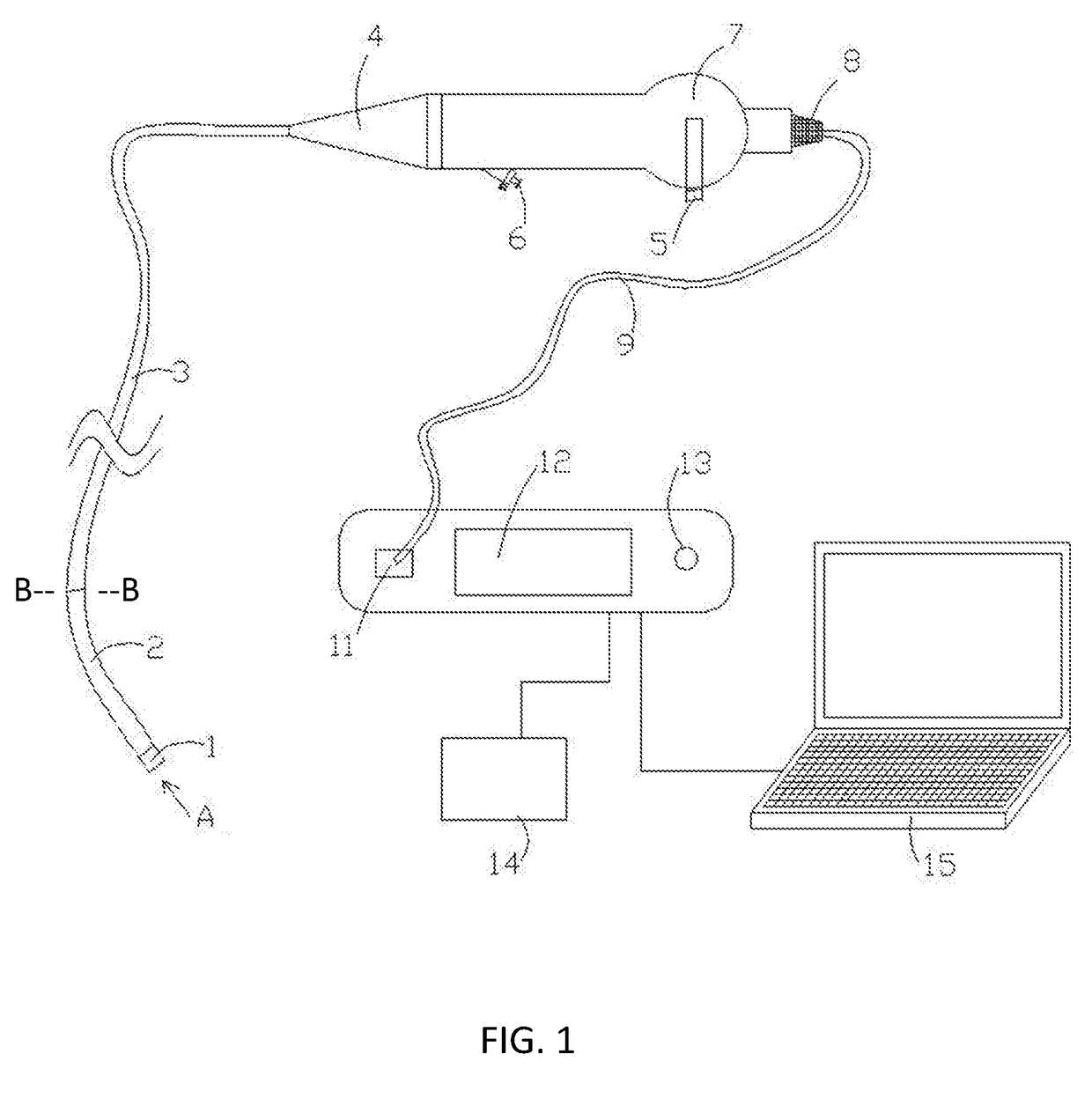 Flexible Digital Ureteroscope