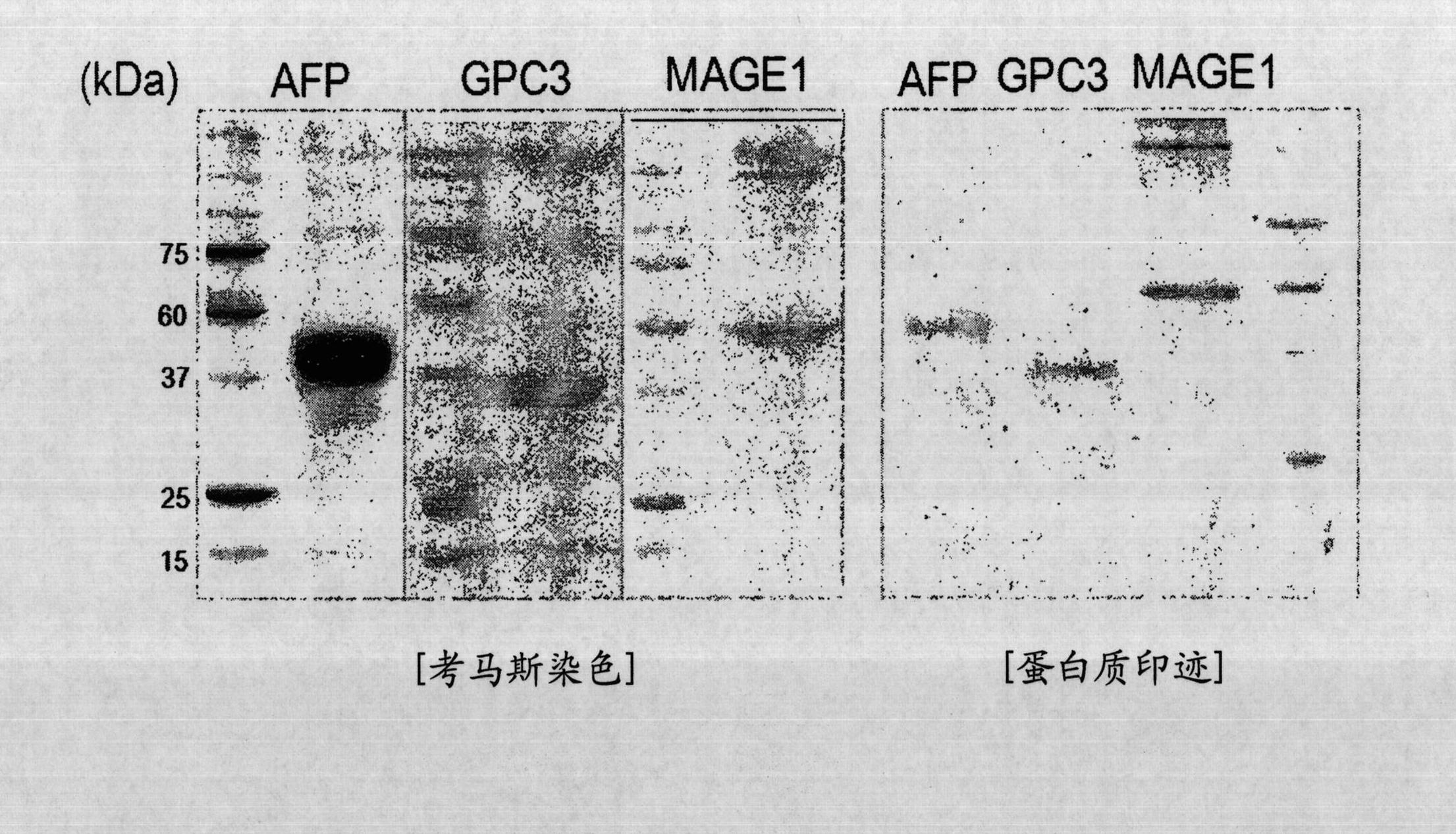 Method for preparing dendritic cells with capacity to induce cancer-specific immune response, and pharmaceutical composition and kit incorporating dendritic cells for preventing or treating cancer or inhibiting metastasis