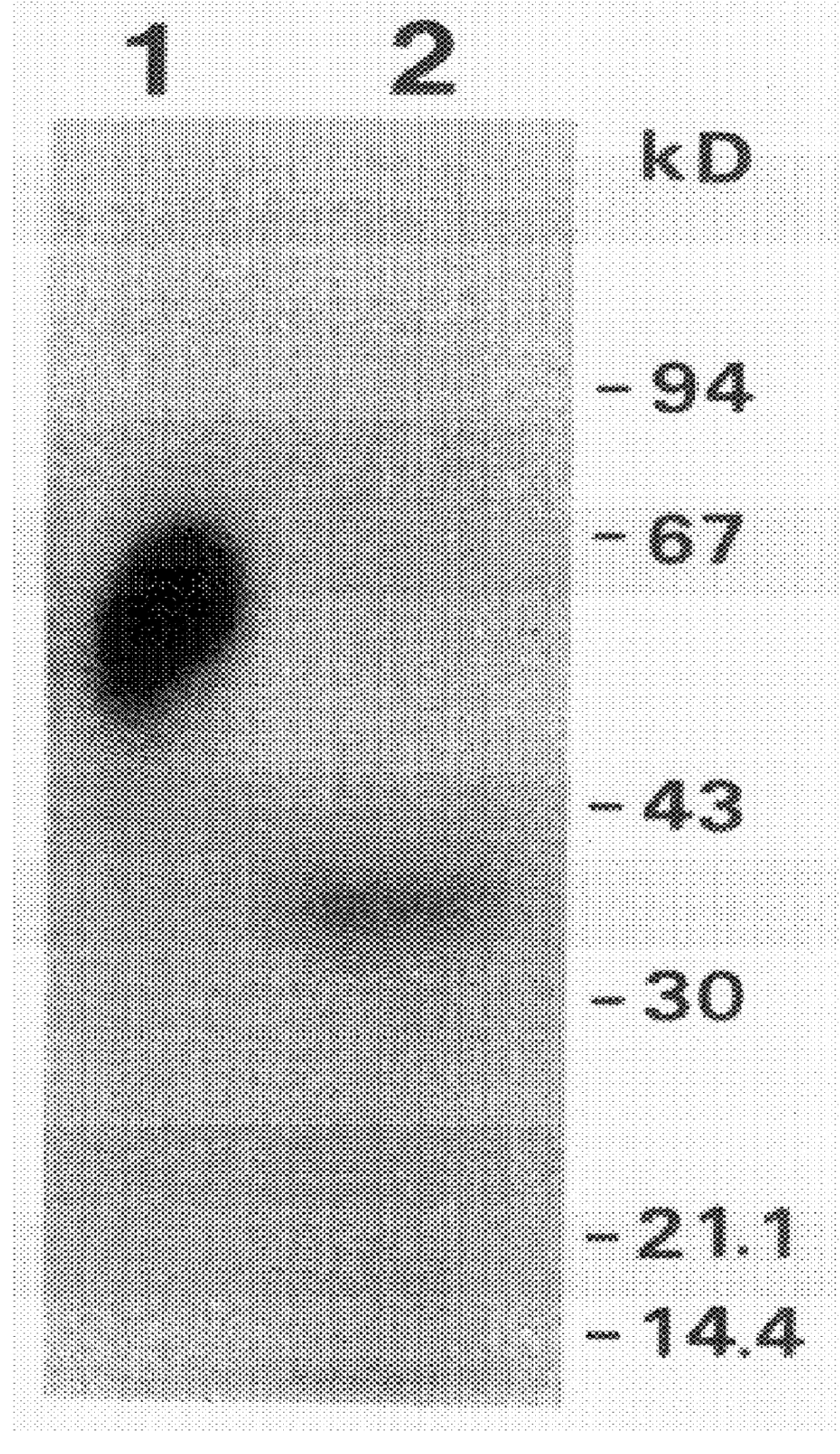 Antibodies and their use