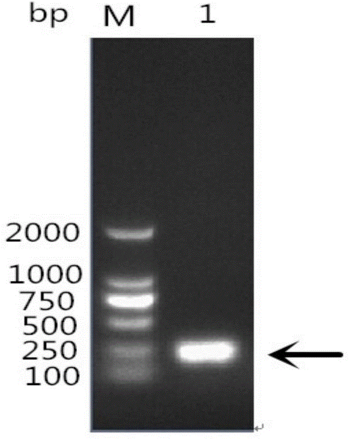 Reagent kit of OmpH interception recombinant protein of riemerella anatipestifer and application thereof