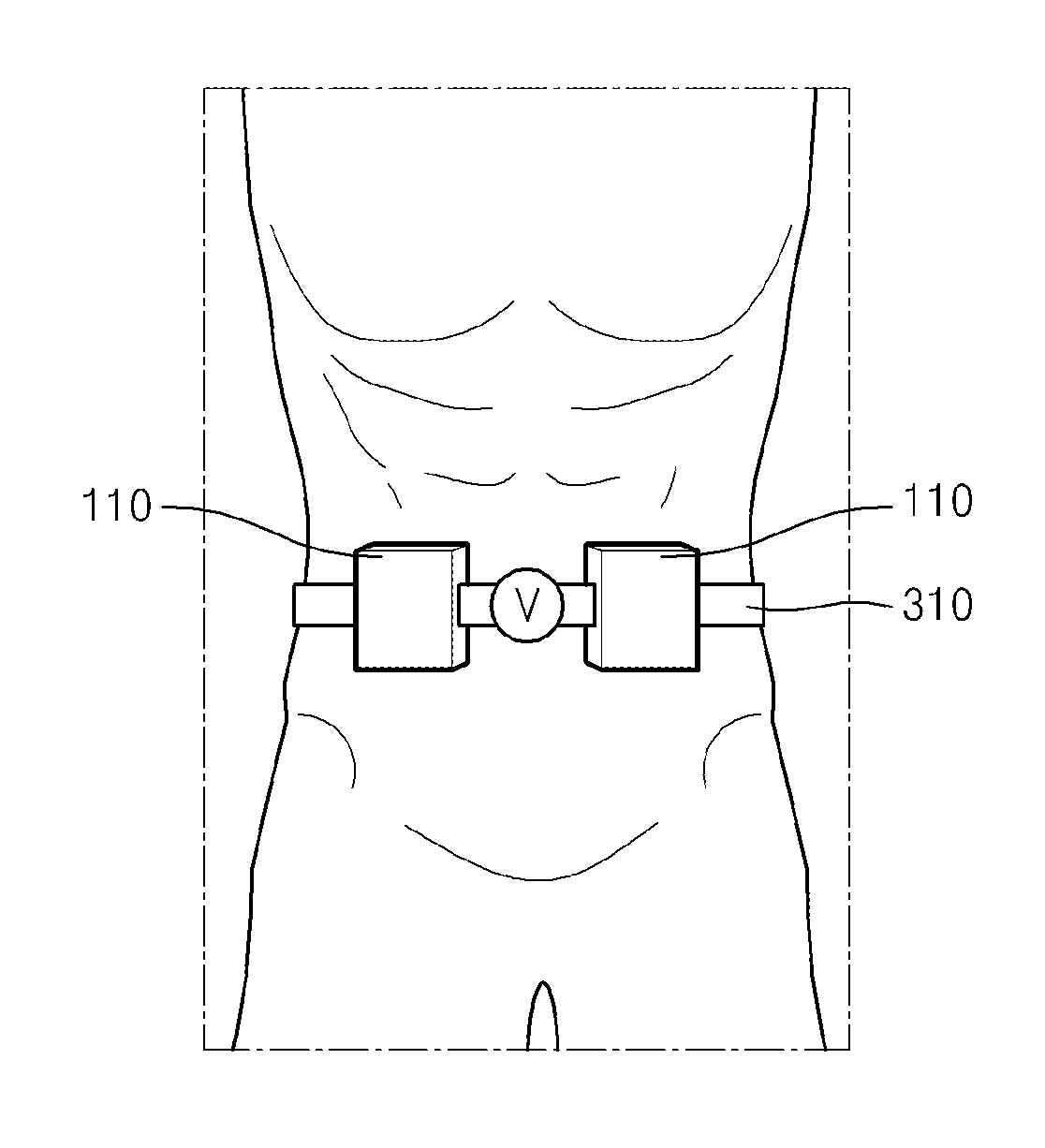 Core stability exercise management system