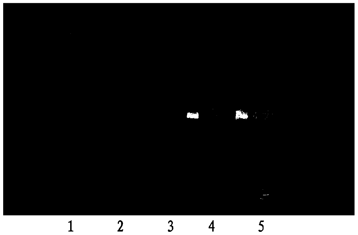 Streptococcus salivarius and its application in the preparation of drugs for removing halitosis