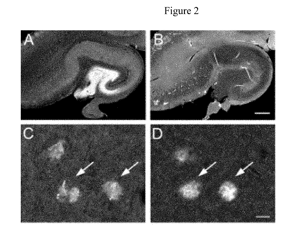 Identification of granins as the pathogenic factor of alzheimer's disease and compositions and methods for inhibiting granin aggregation and treating alzheimer's disease