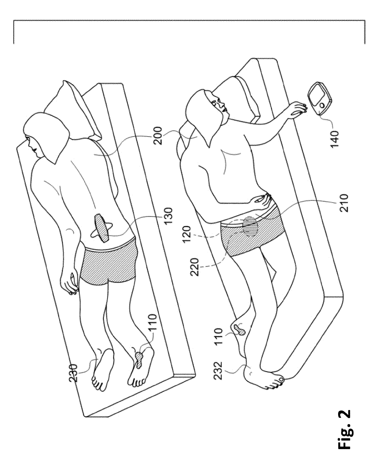 Nocturia Reduction System