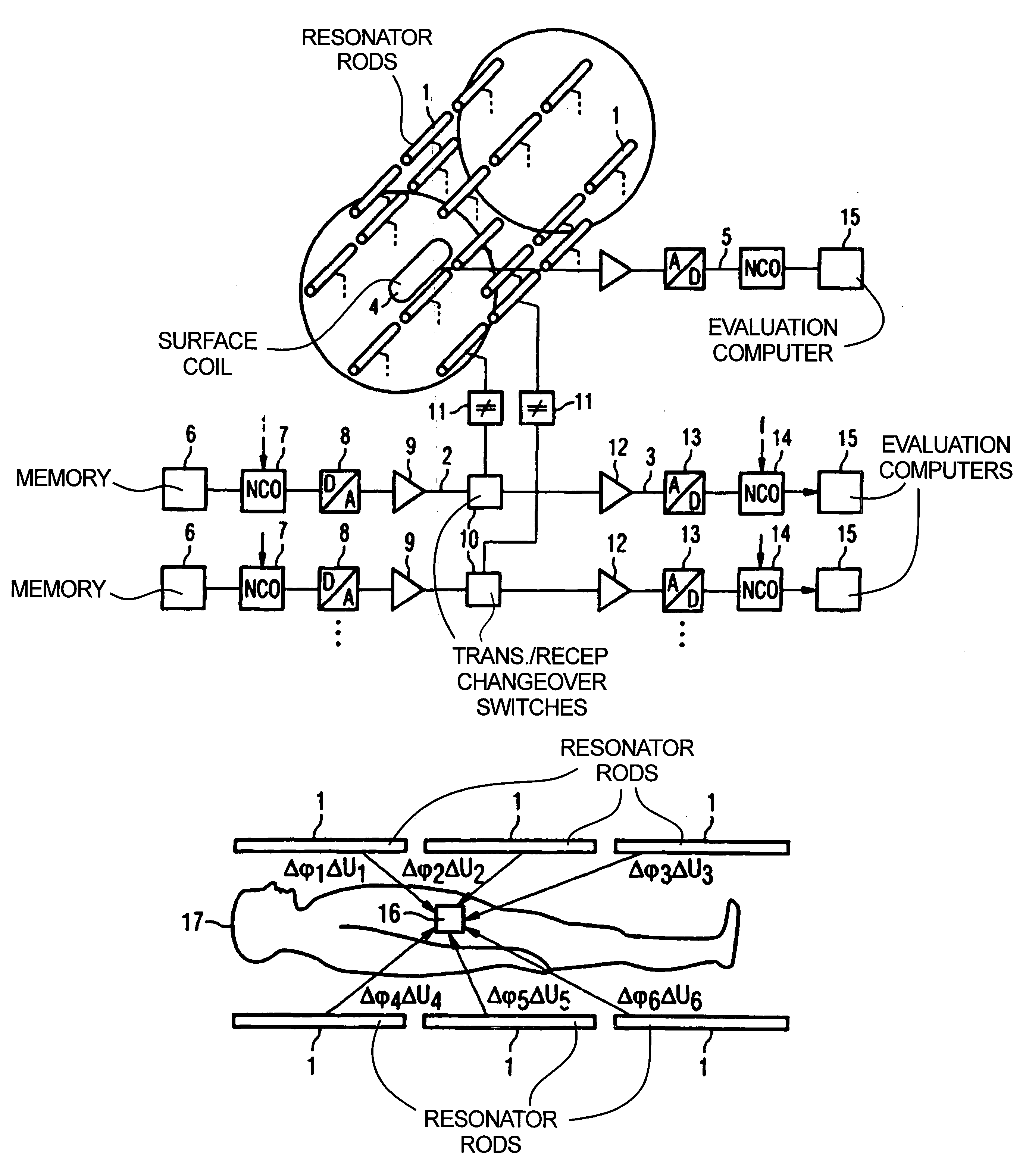 Magnetic resonance apparatus and operation method for hyperthermic treatment