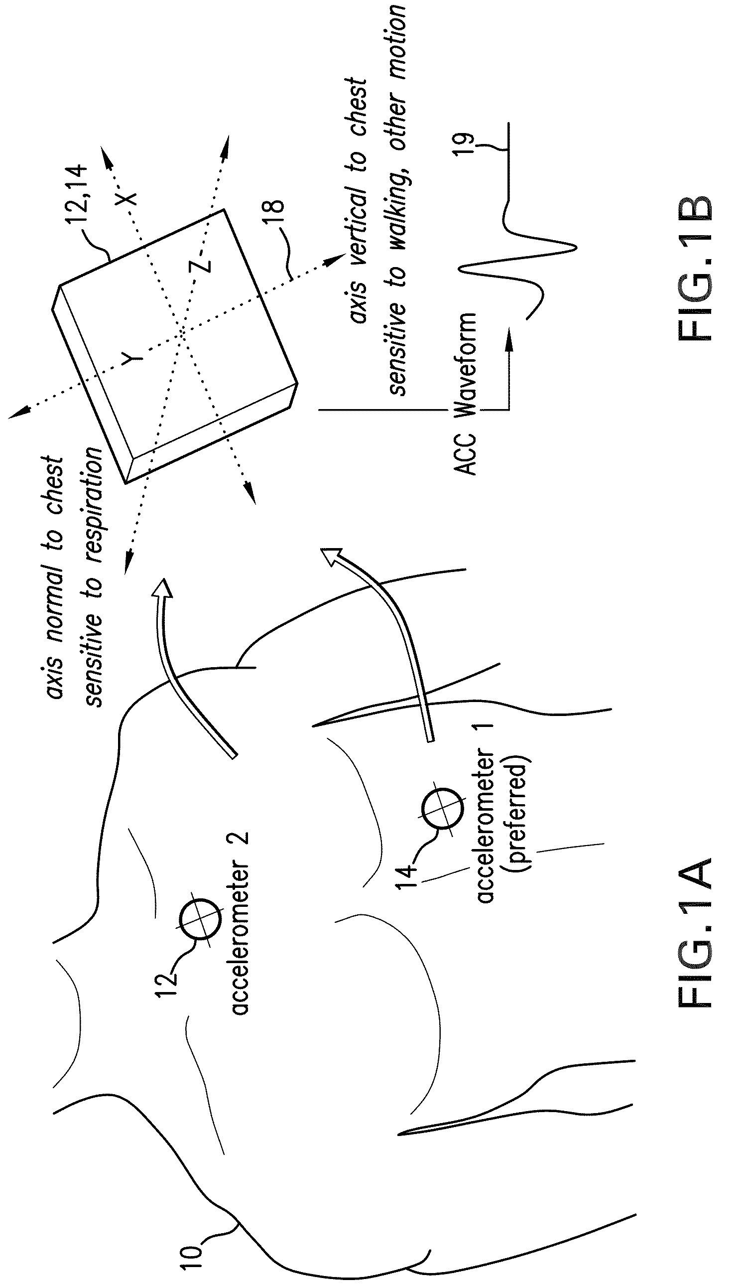 Body-worn monitor for measuring respiration rate