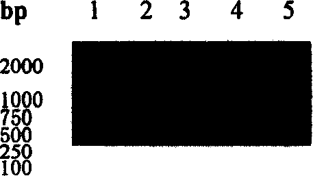 Method of expressing human apolipoprotein ApoA I inside Pichia yeast cell