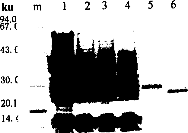 Method of expressing human apolipoprotein ApoA I inside Pichia yeast cell