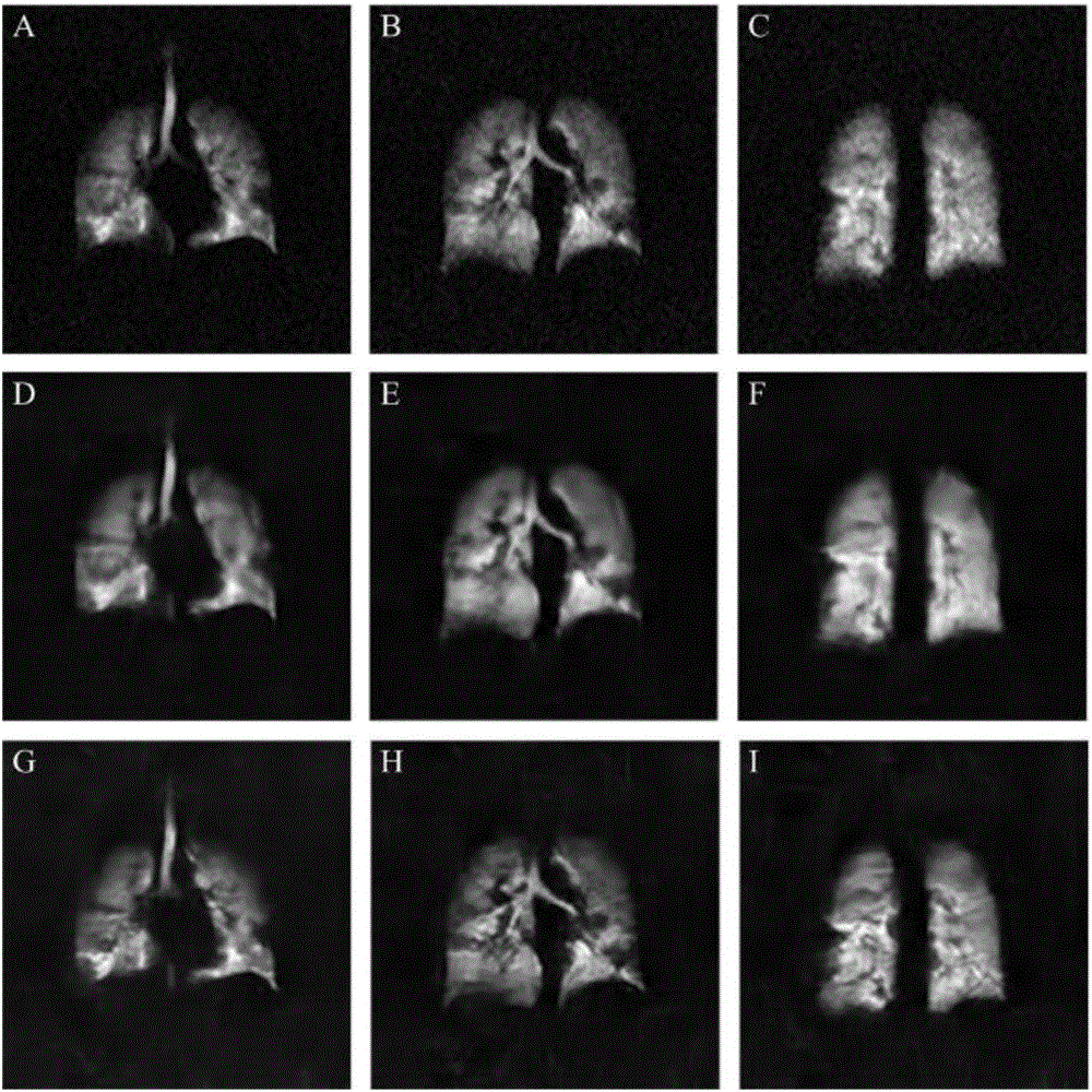 Image processing method of hyperpolarized gas magnetic resonance