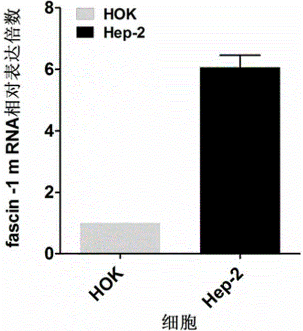 Human fascin-1 gene siRNA and applications thereof