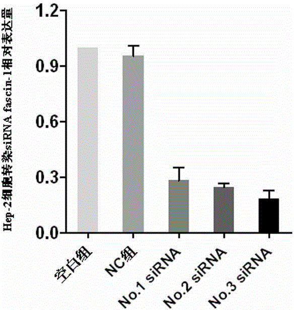 Human fascin-1 gene siRNA and applications thereof