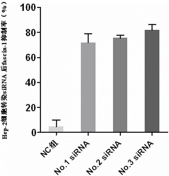 Human fascin-1 gene siRNA and applications thereof