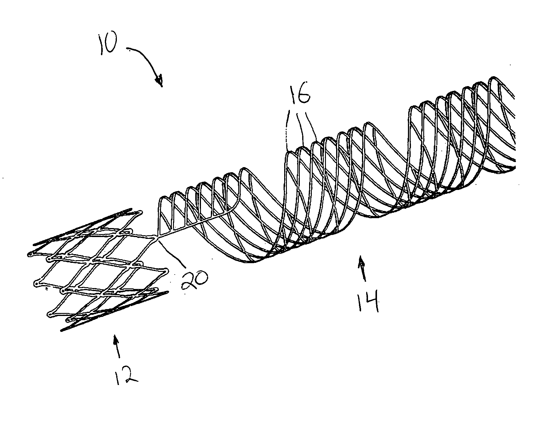 Vascular prothesis having flexible configuration