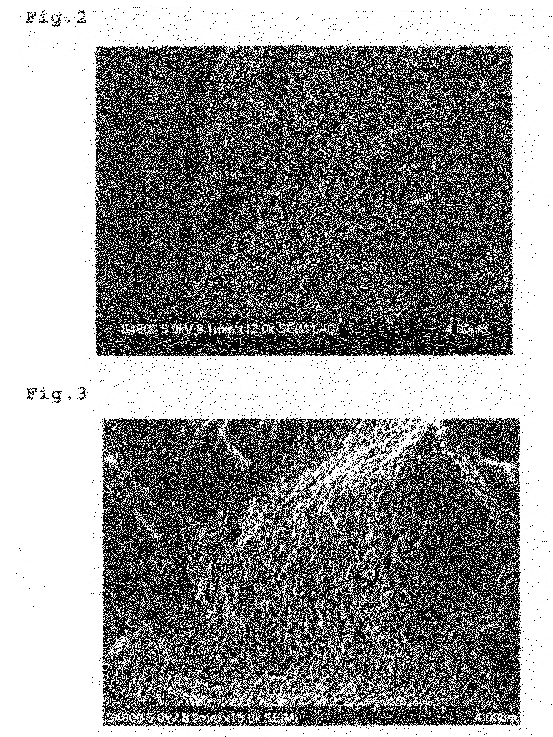 Biodegradable Inverted-Opal Structure, Method for Manufacturing and Using the Same, and Medical Implant Comprising the Biodegradable Inverted-Opal Structure