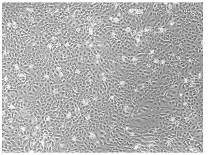 Construction method of human amniotic epithelial stem cell bank