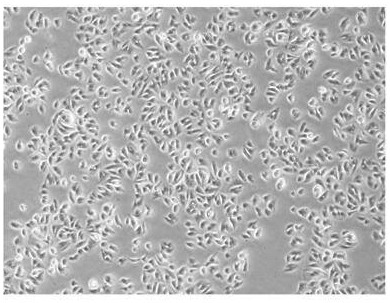 Construction method of human amniotic epithelial stem cell bank