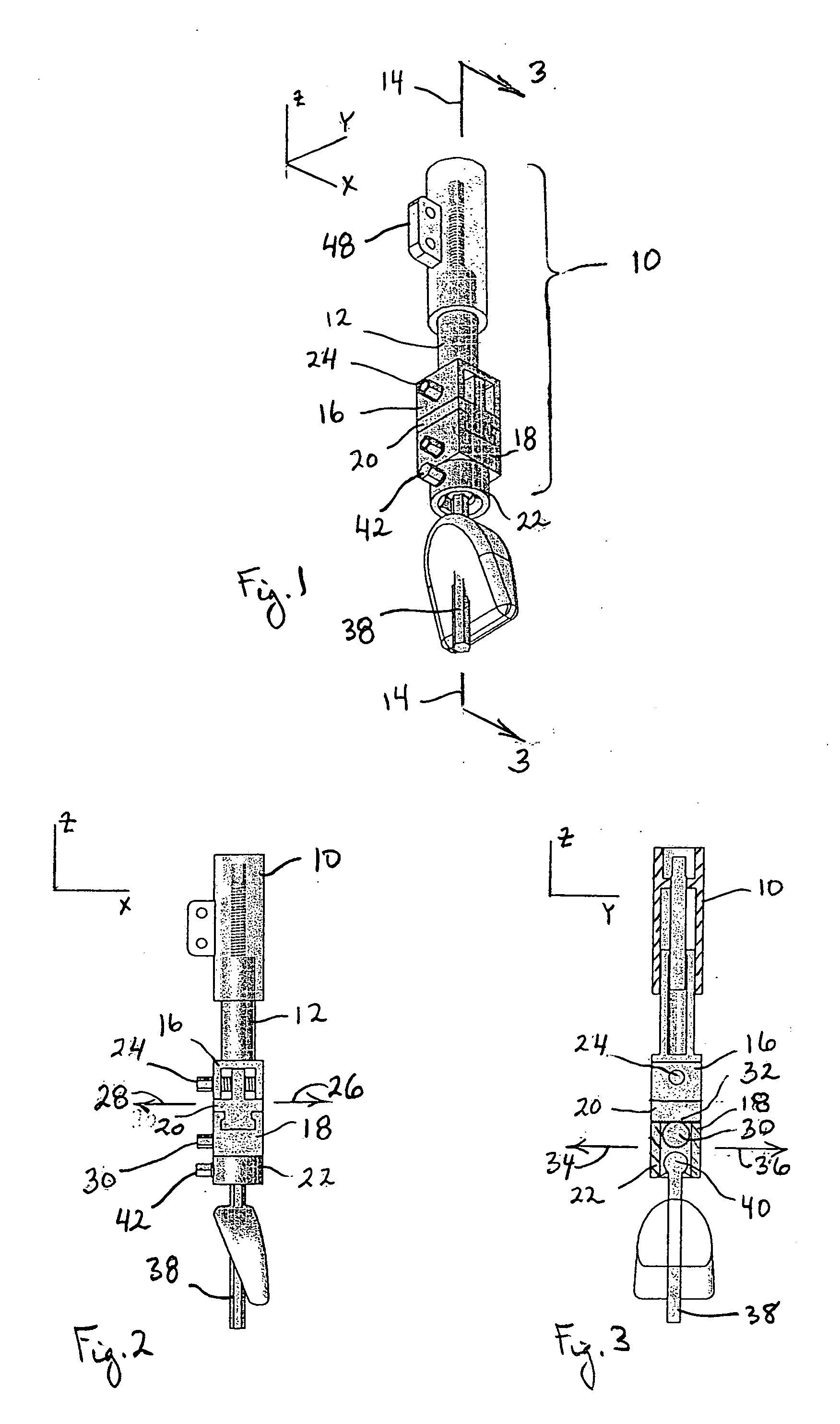 Method and apparatus for repositioning teeth