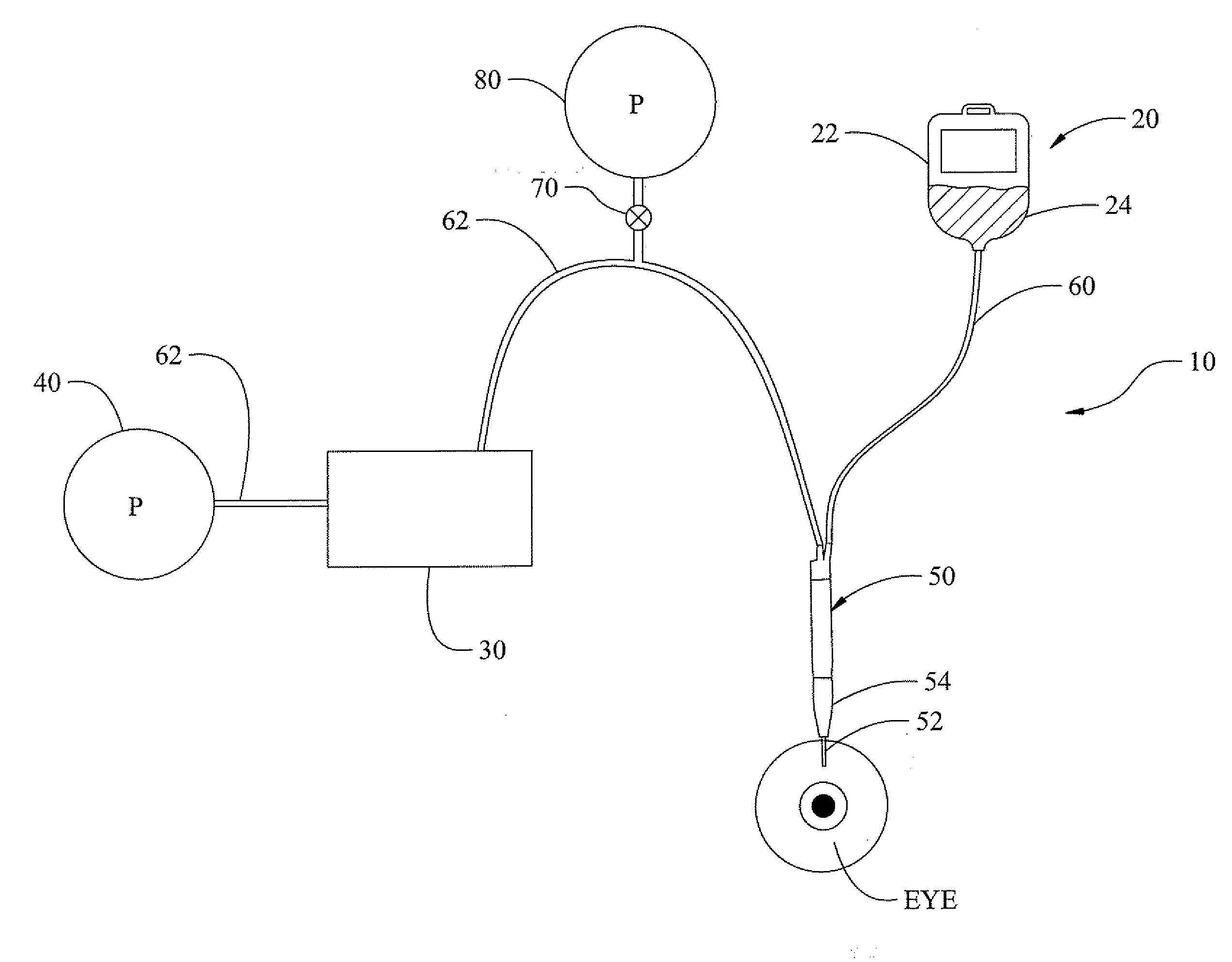 Surgical System Having Means for Pressurizing Venting Valve