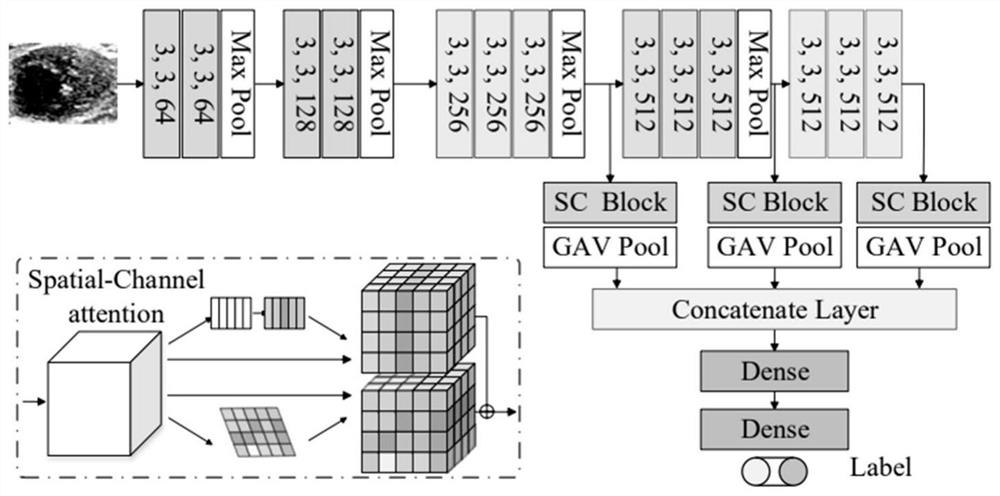 Lymph node classification method, system and device based on multi-view semi-supervision