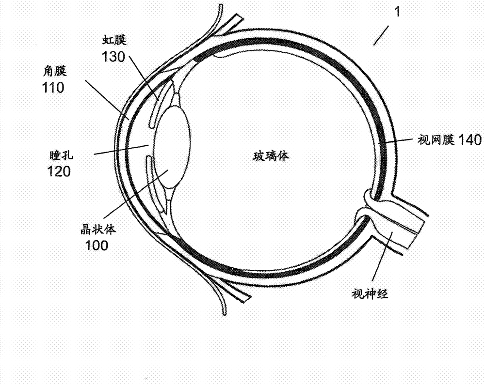 Method to guide a cataract procedure by corneal imaging