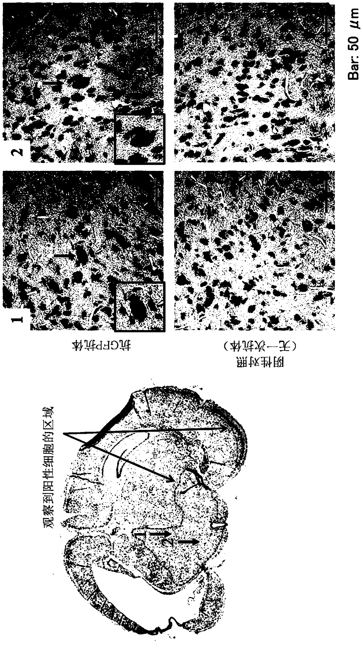 Amelioration and treatment of perinatal brain damage with pluripotent stem cells