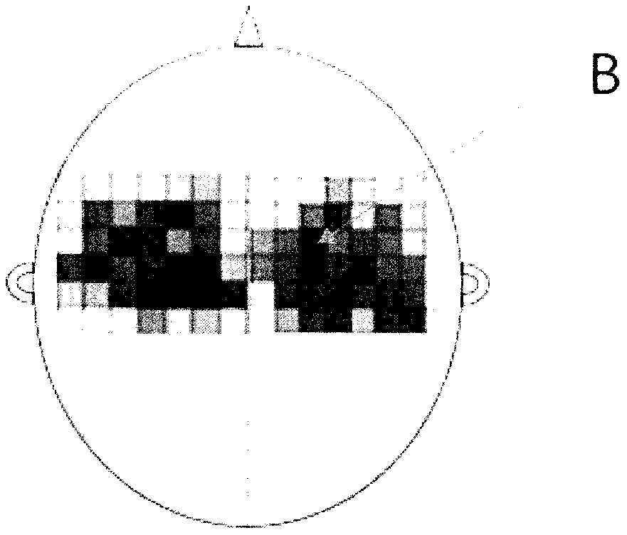 Drawing method for MEP topographic map of pharyngeal motor cortex area