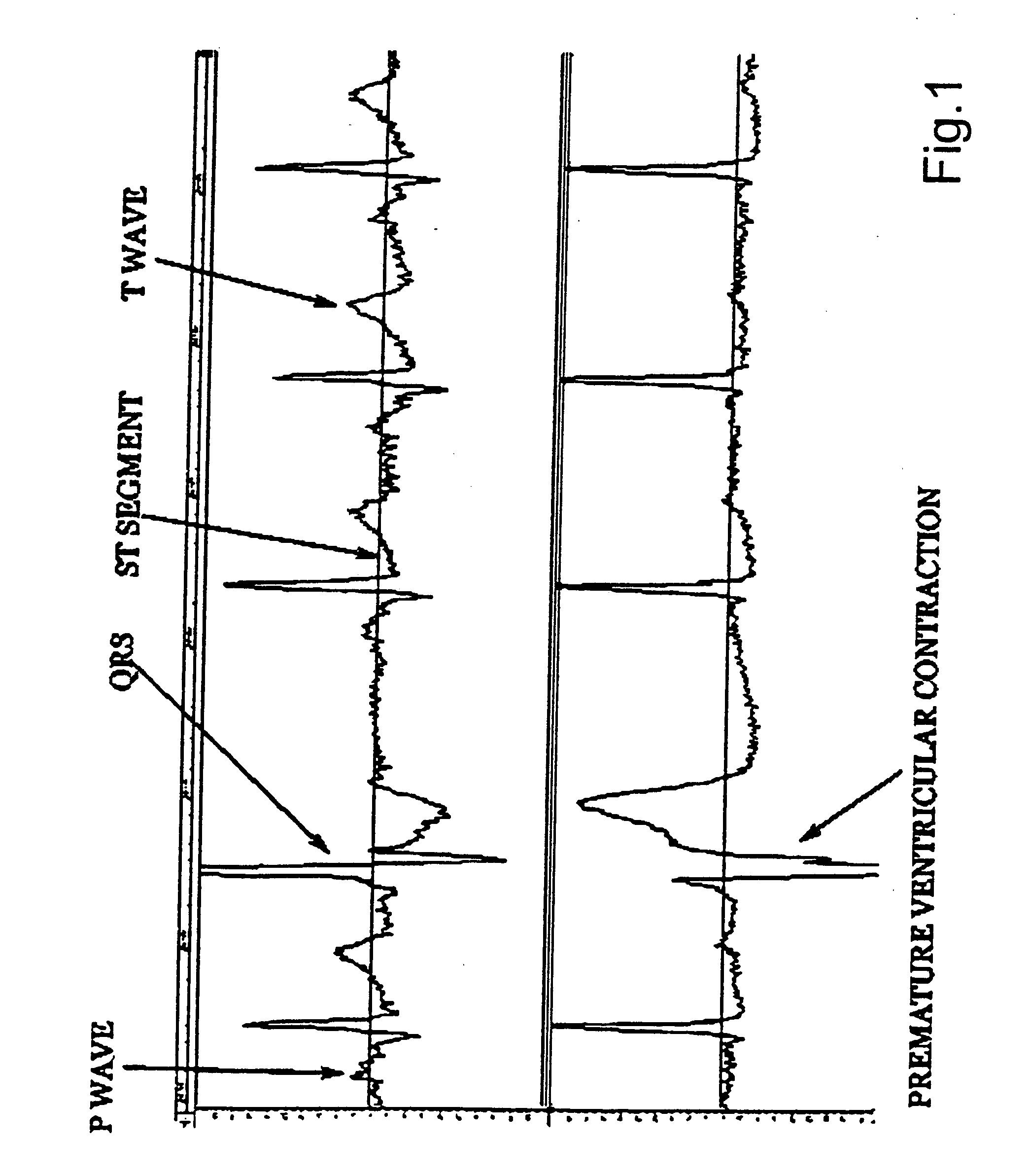 System for analysis of biological voltage signals