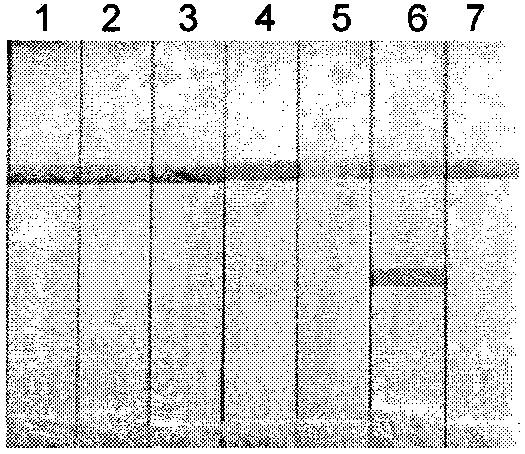 Constant-temperature amplification detection kit for dengue viruses and detection method