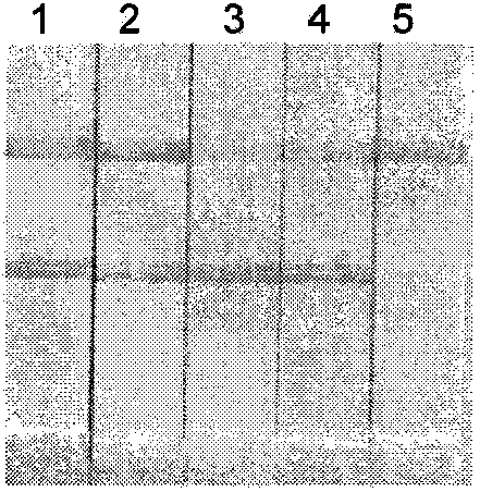 Constant-temperature amplification detection kit for dengue viruses and detection method