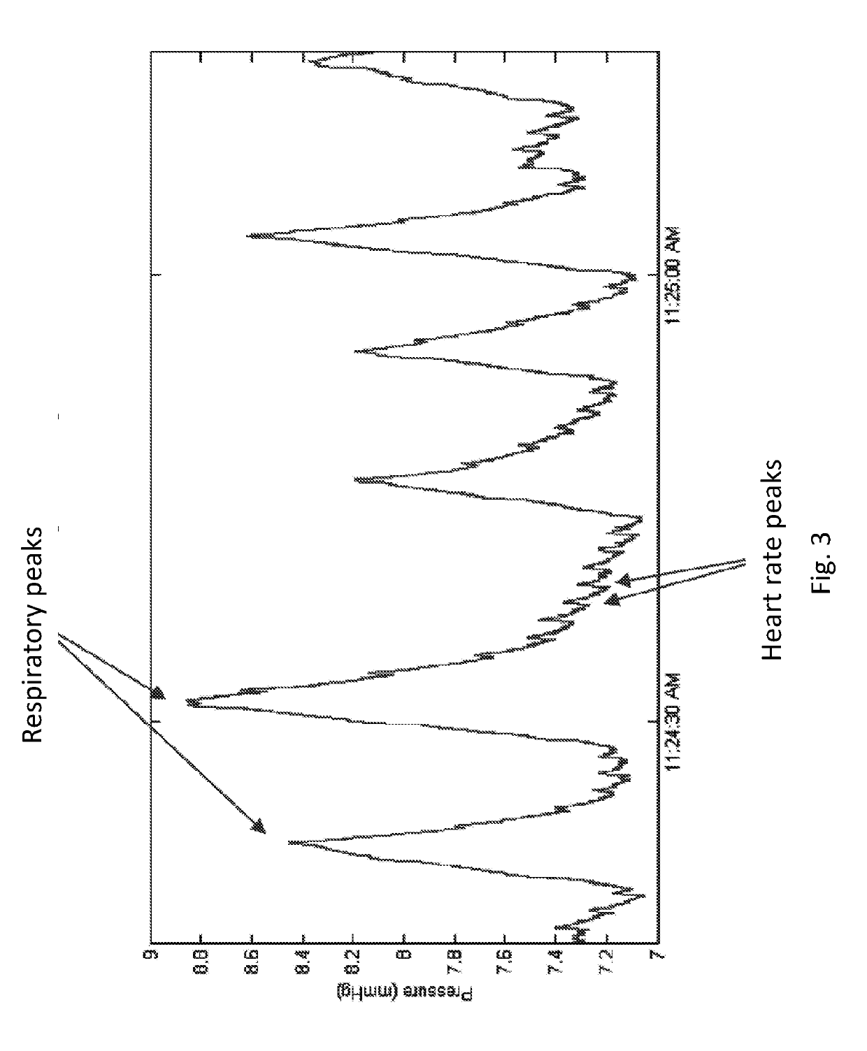 Systems, devices and methods for draining and analyzing bodily fluids