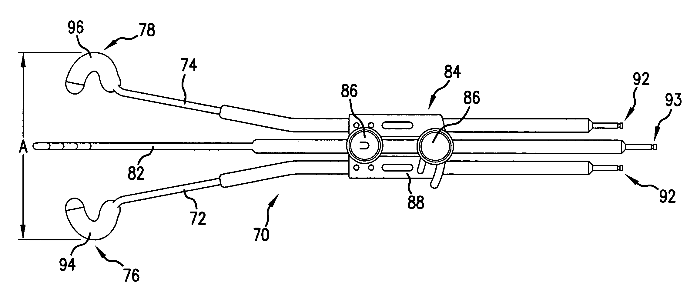 Split-ring brachytherapy device and method for cervical brachytherapy treatment using a split-ring brachytherapy device