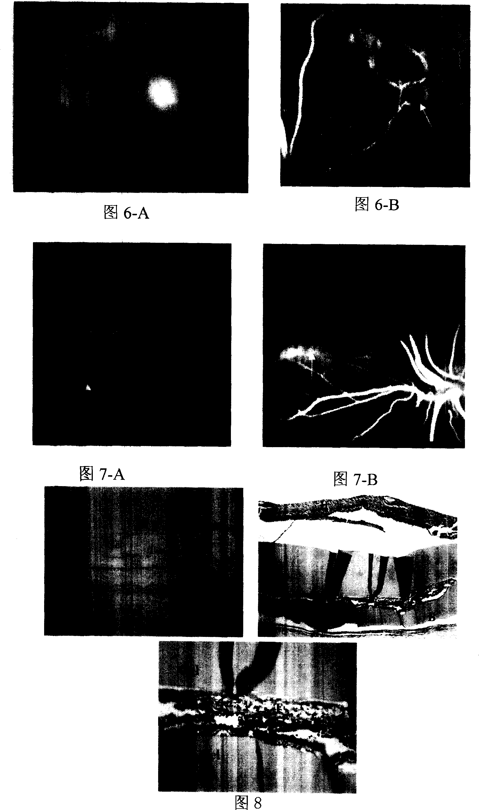 Method for in vitro separation of full-thickness retina tissue