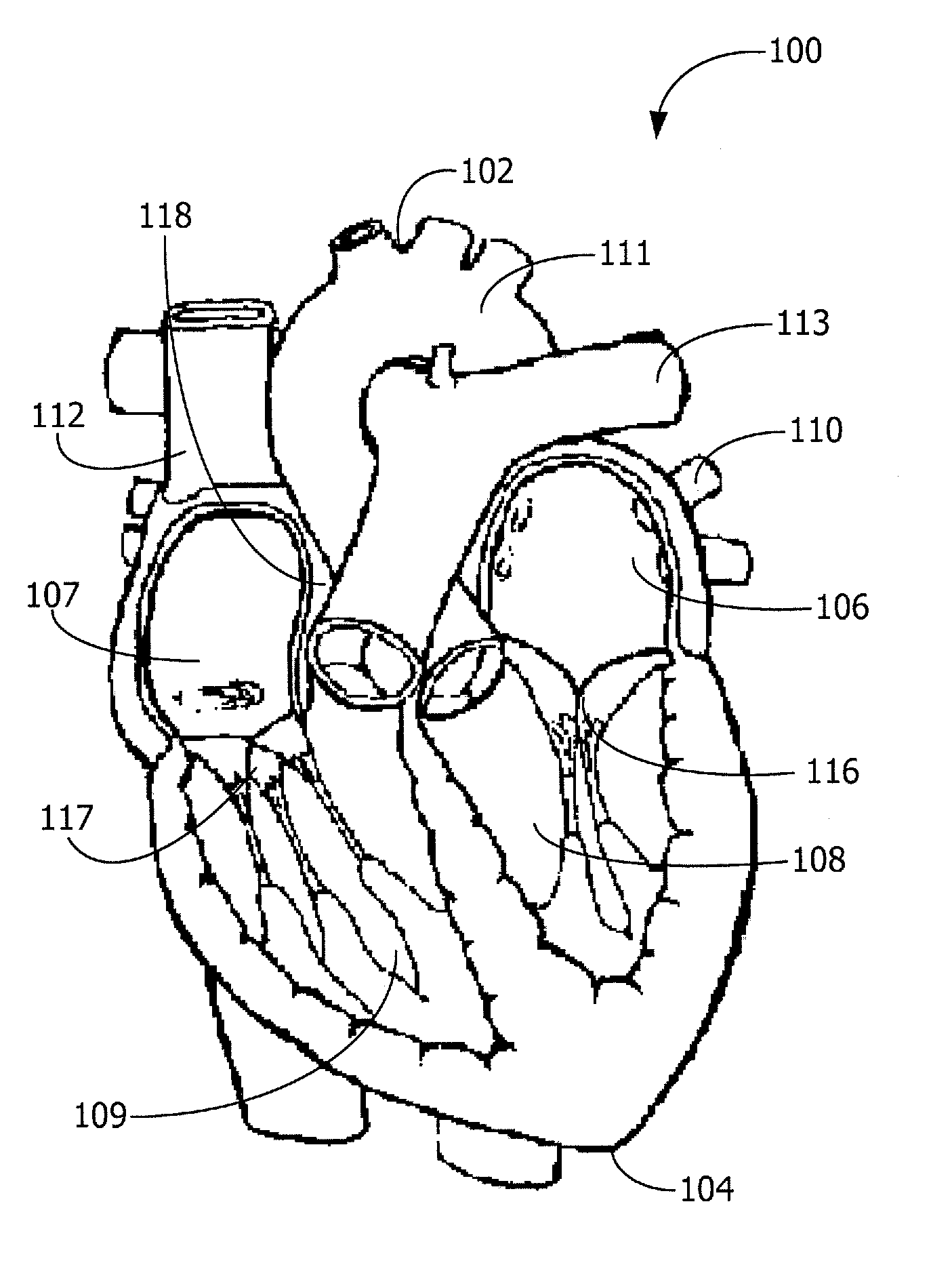 Comprehensive System for Detection of Coronary Syndrome, Cardiac Ischemia and Myocardial Infarction