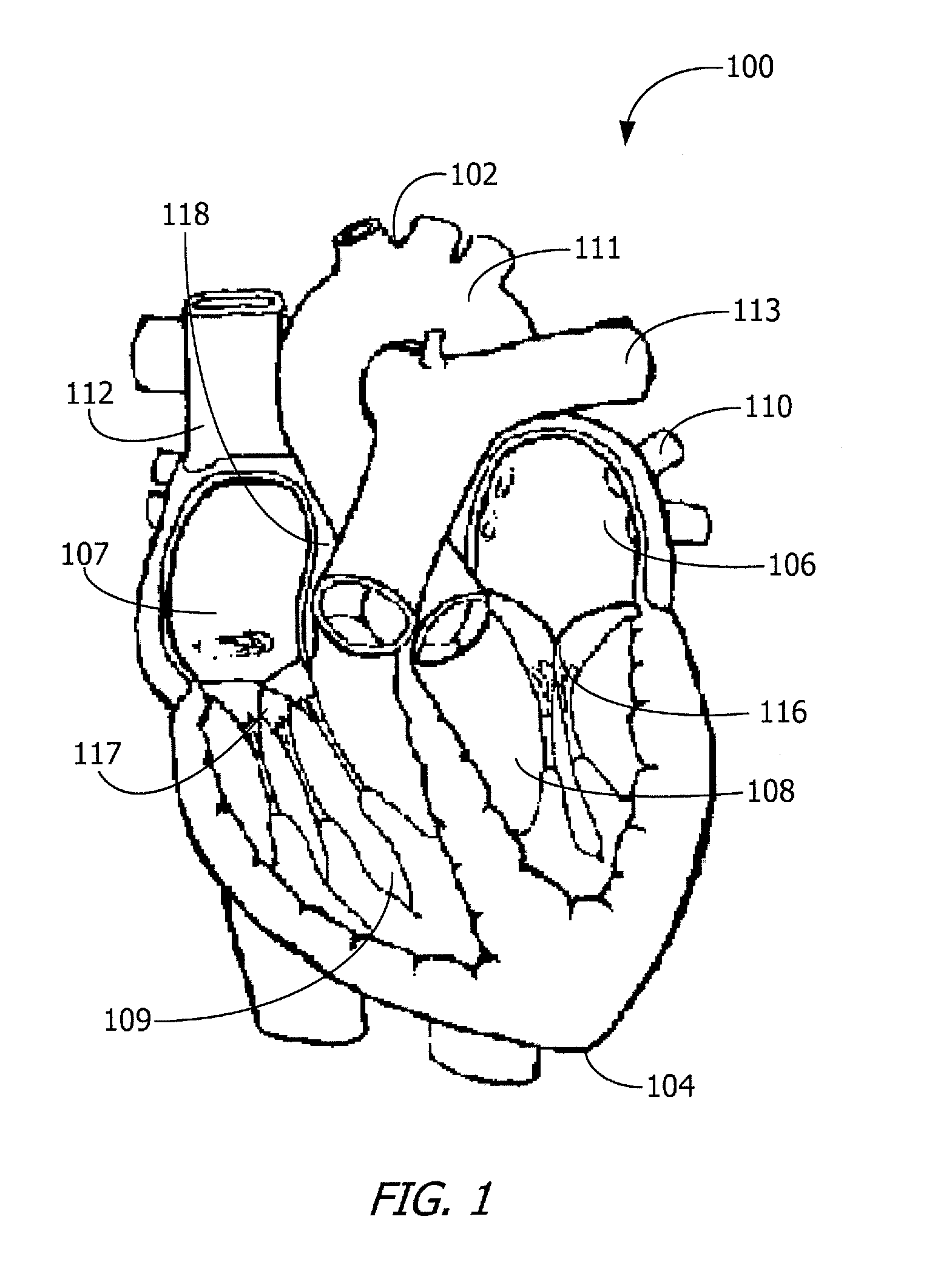 Comprehensive System for Detection of Coronary Syndrome, Cardiac Ischemia and Myocardial Infarction