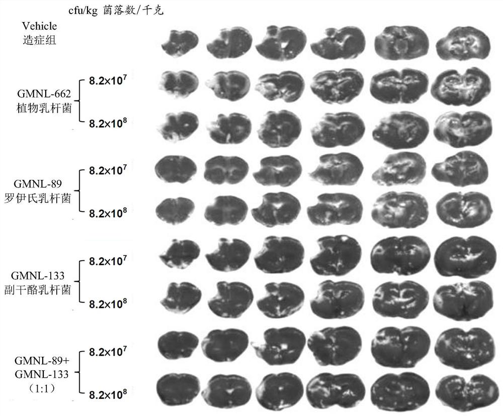 Composition for preventing stroke and improving stroke severity and use thereof