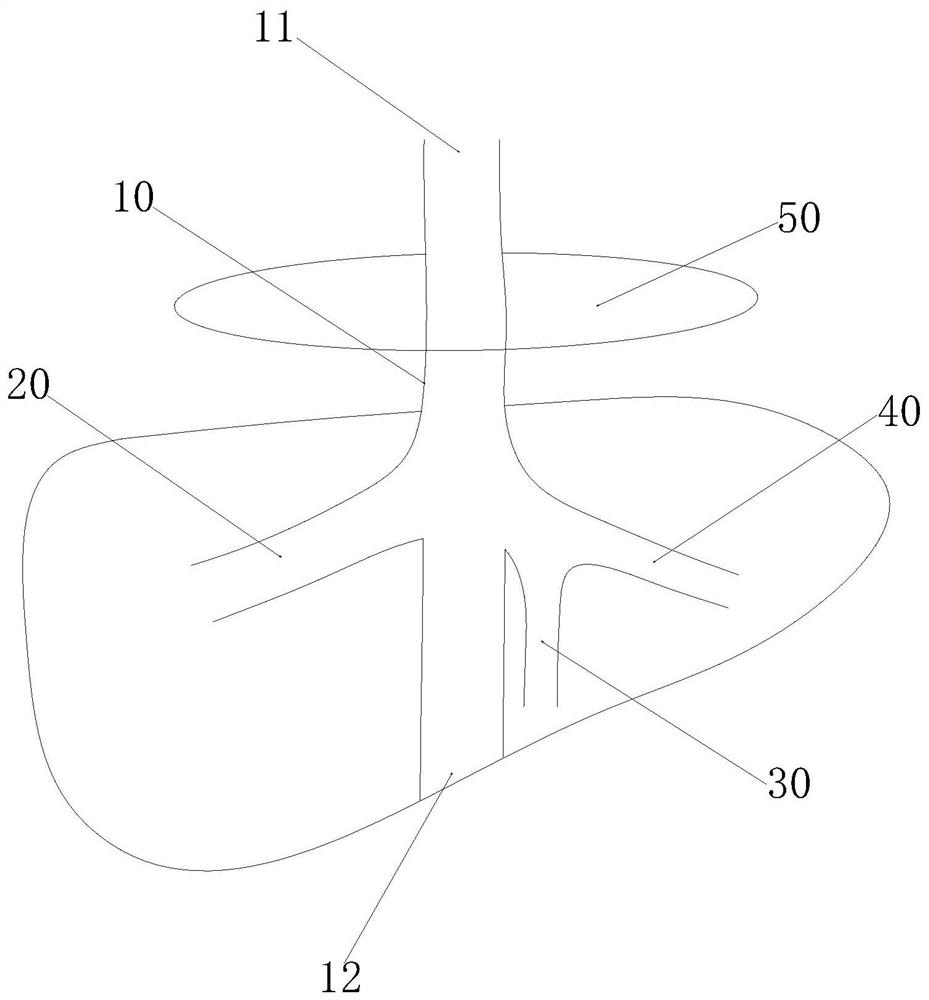 Artificial blood vessel