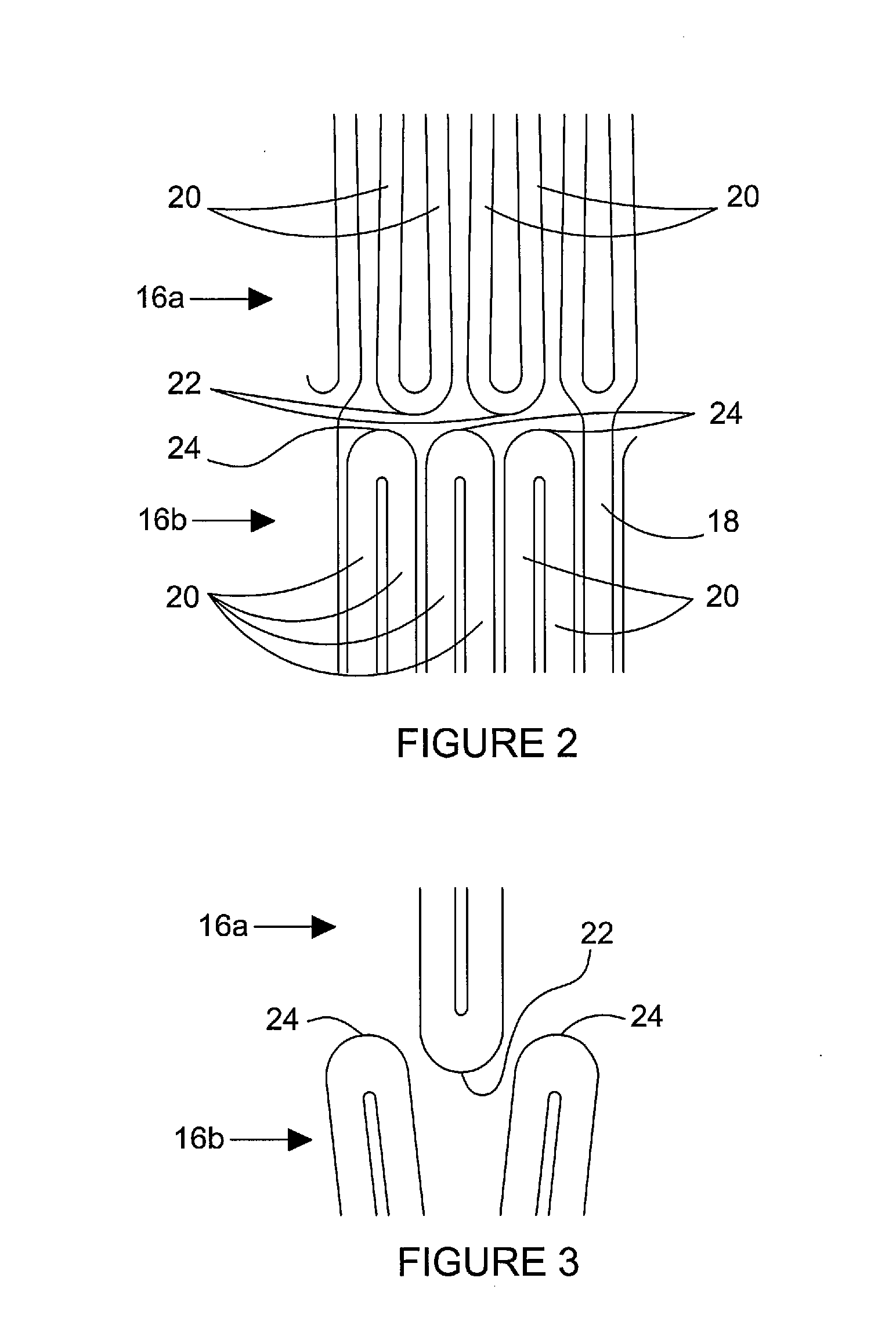 Prosthesis and method of manufacturing the same