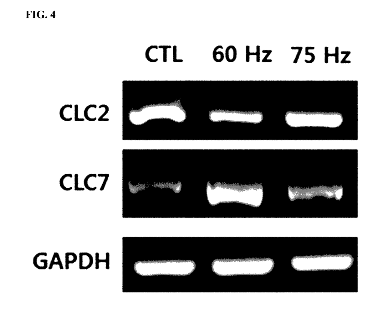 Method of differentiating adult stem cells into nerve cells by using high-intensity electromagnetic field