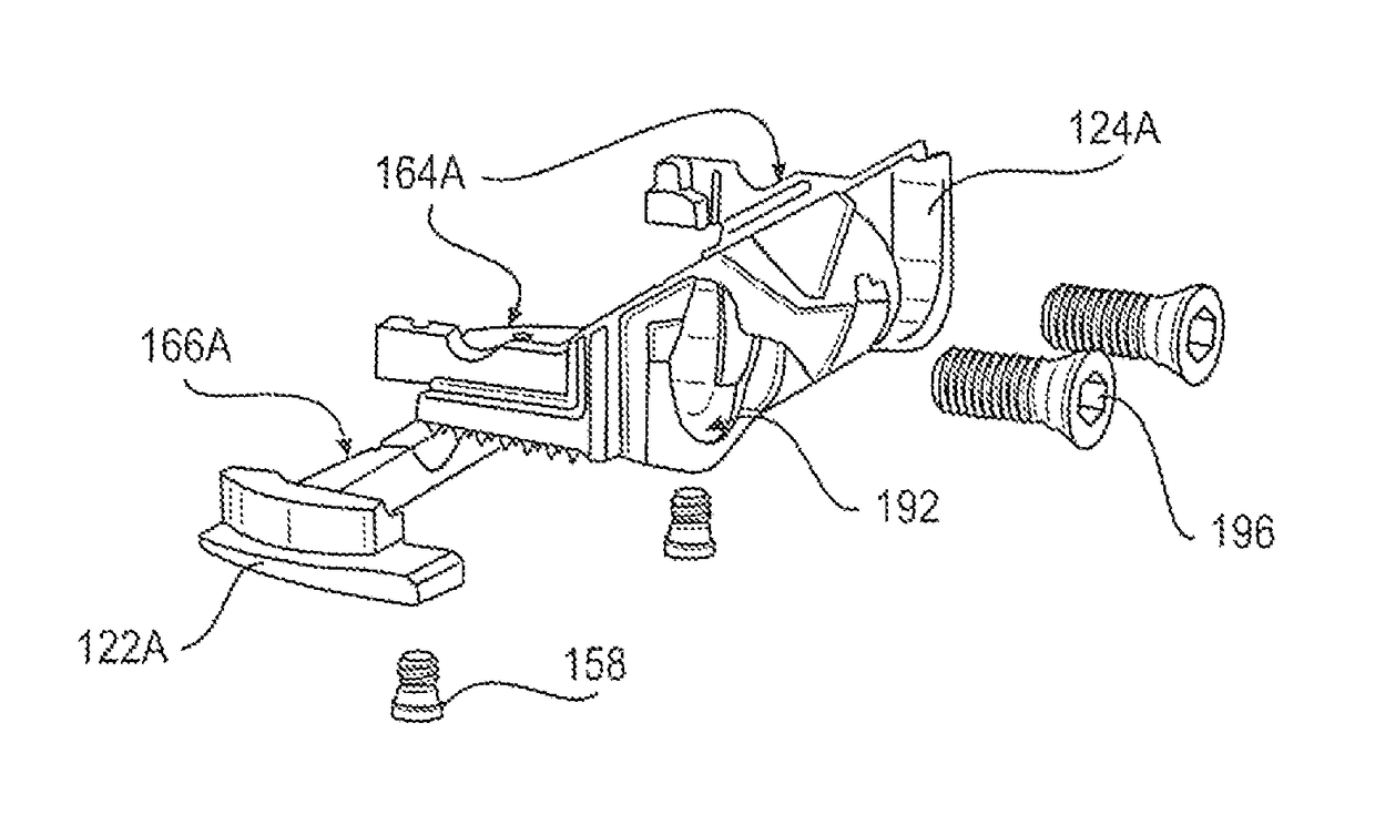 Expandable intervertebral implant