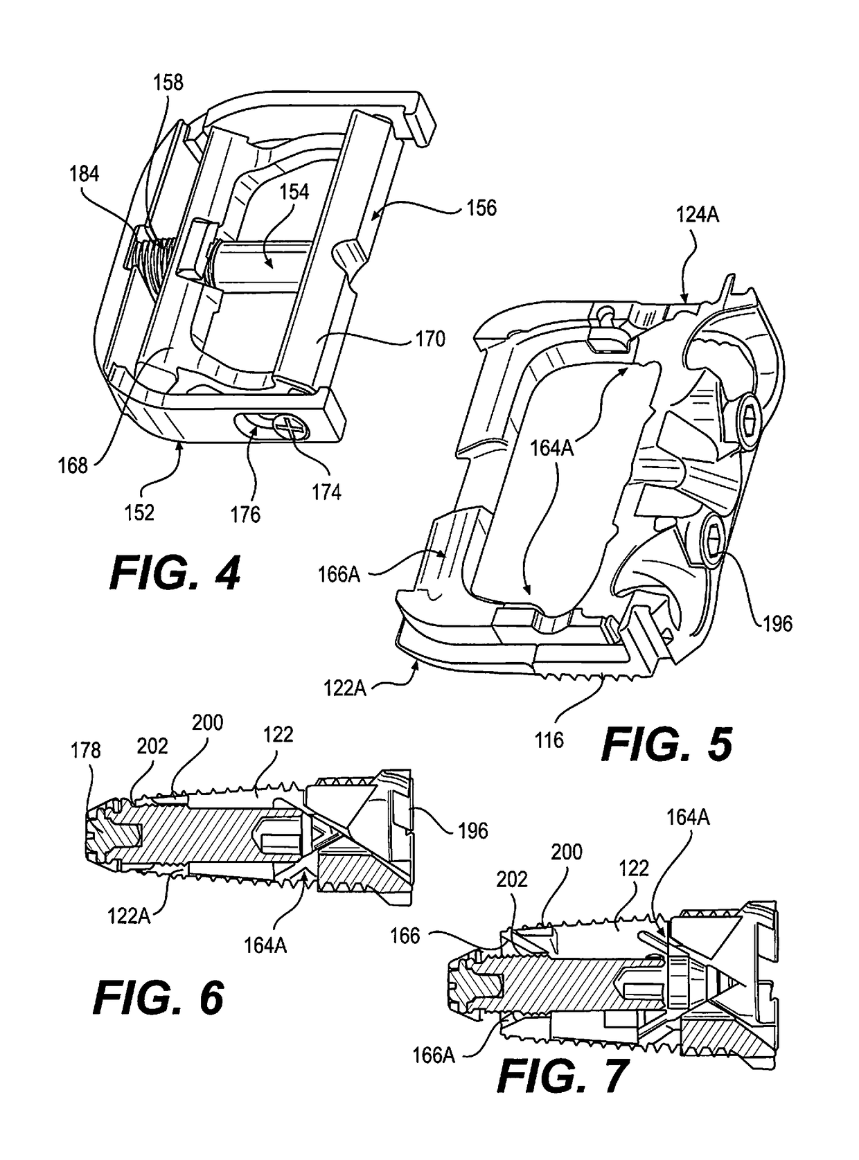 Expandable intervertebral implant