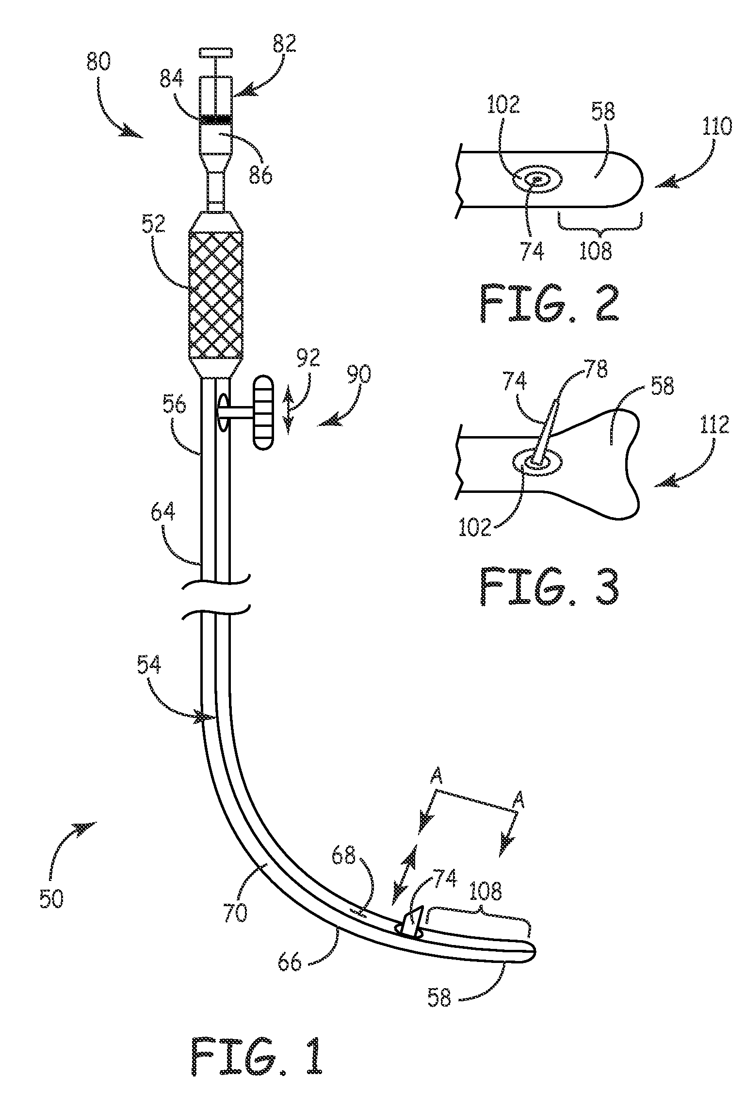 Method for treatment of macular degeneration