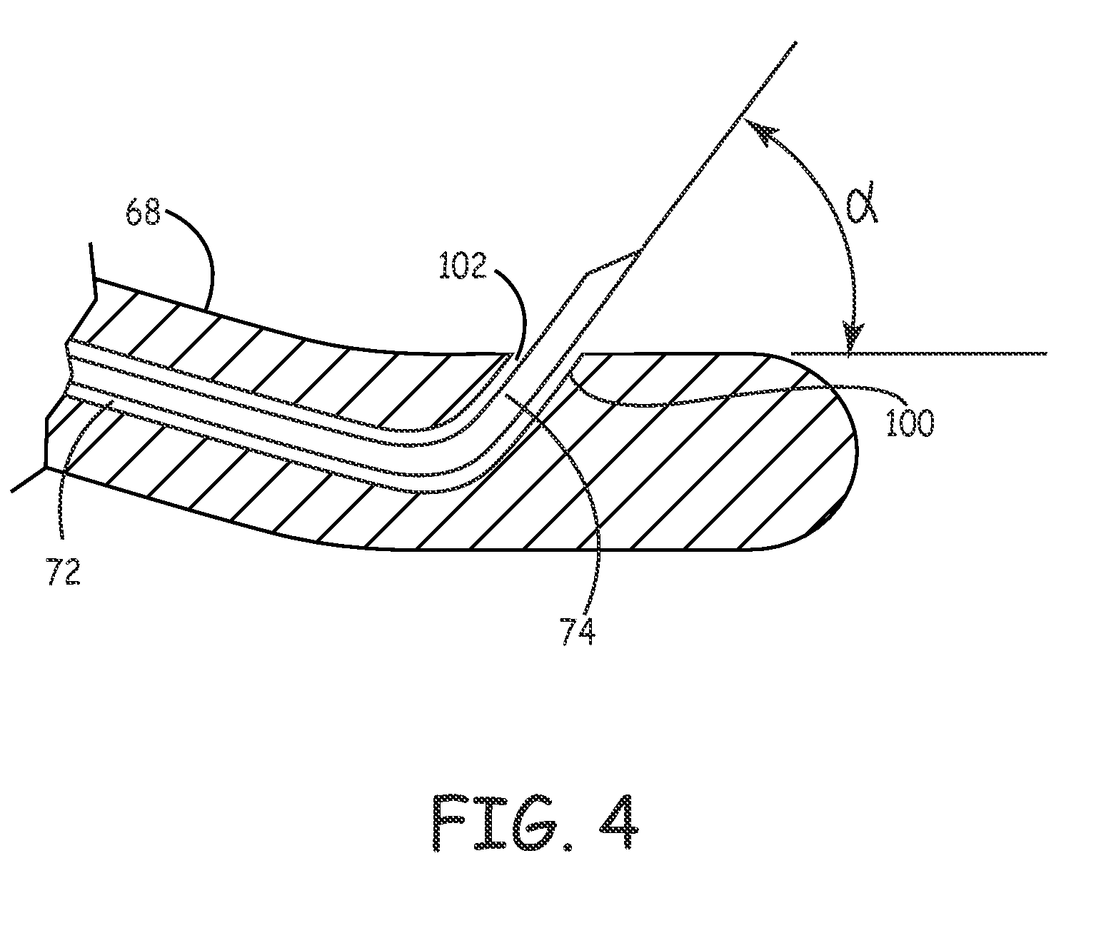 Method for treatment of macular degeneration