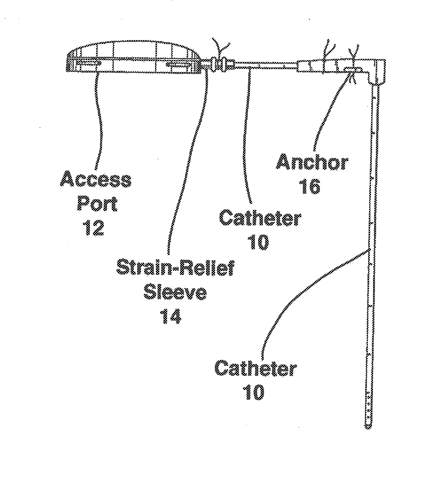 Compositions, devices and methods for treatment of huntington's disease through intracranial delivery of sirna