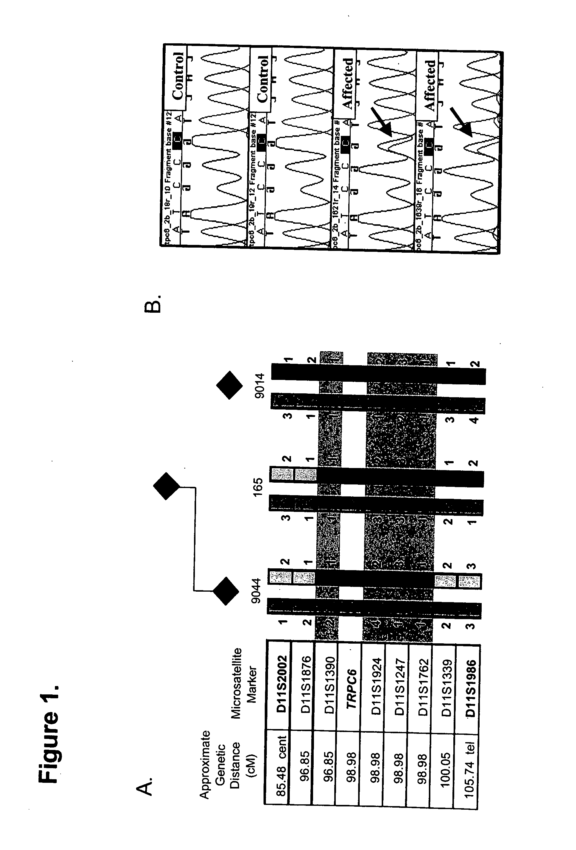 TRPC6 involved in glomerulonephritis