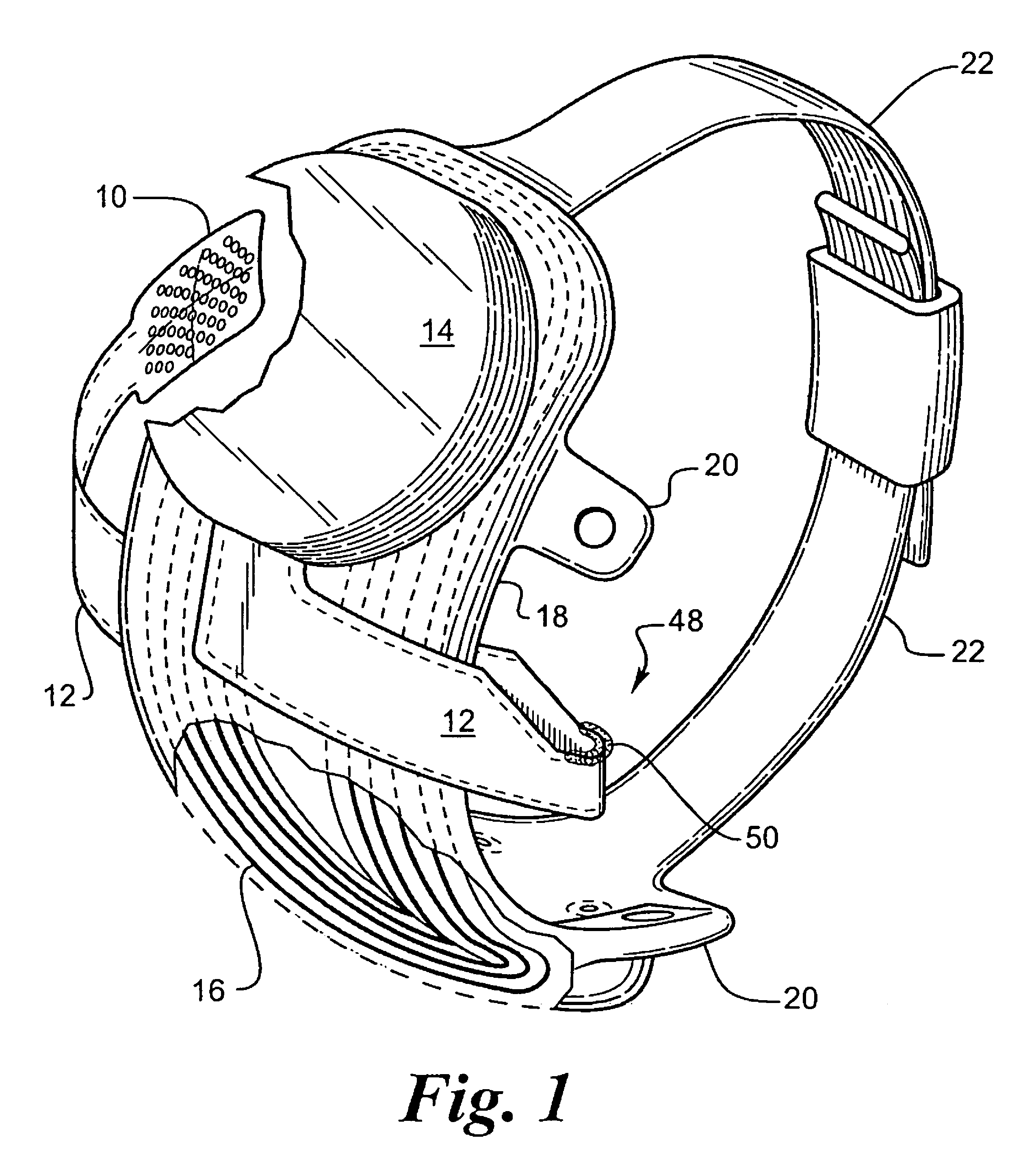 Flexible circuit electrode array and method of manufacturing the same